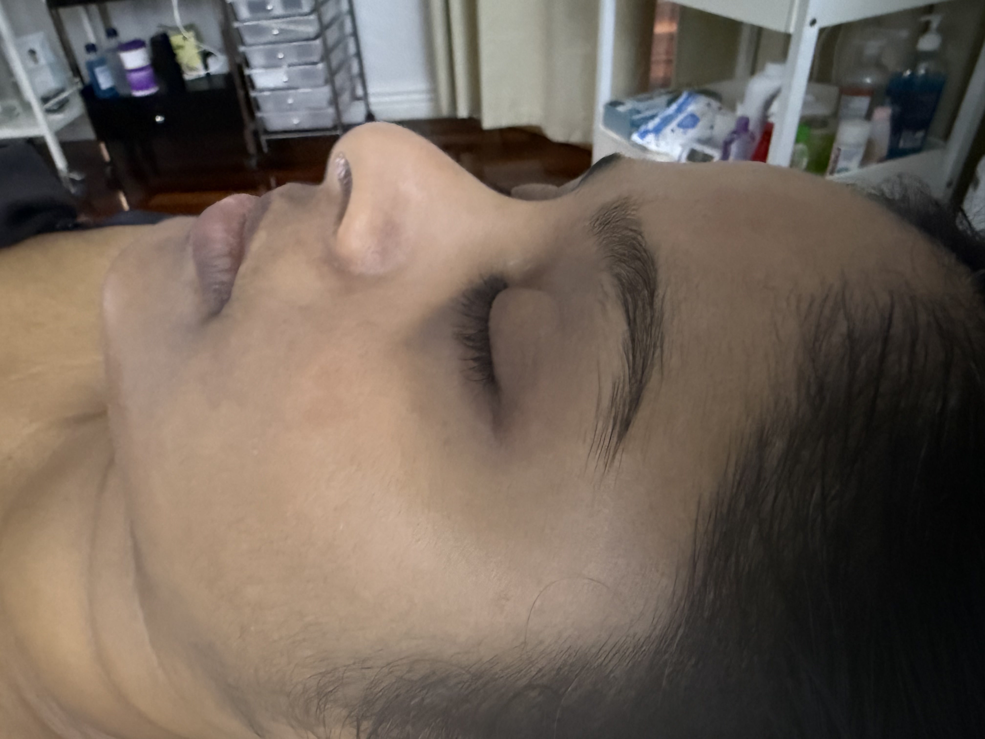 Dermaplaning facial skin prep