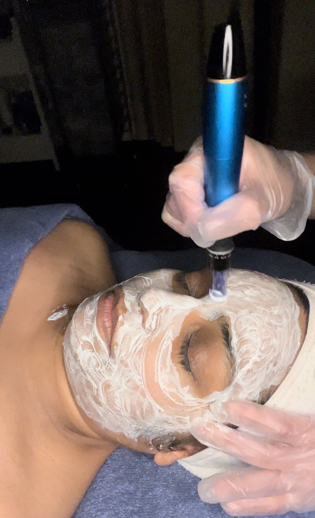 Pure Diamond microdermabrasion
